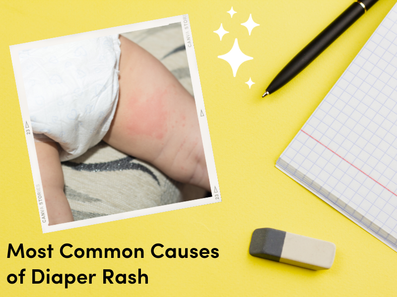 The 5 Most Common Causes of Diaper Rash La Petite Creme