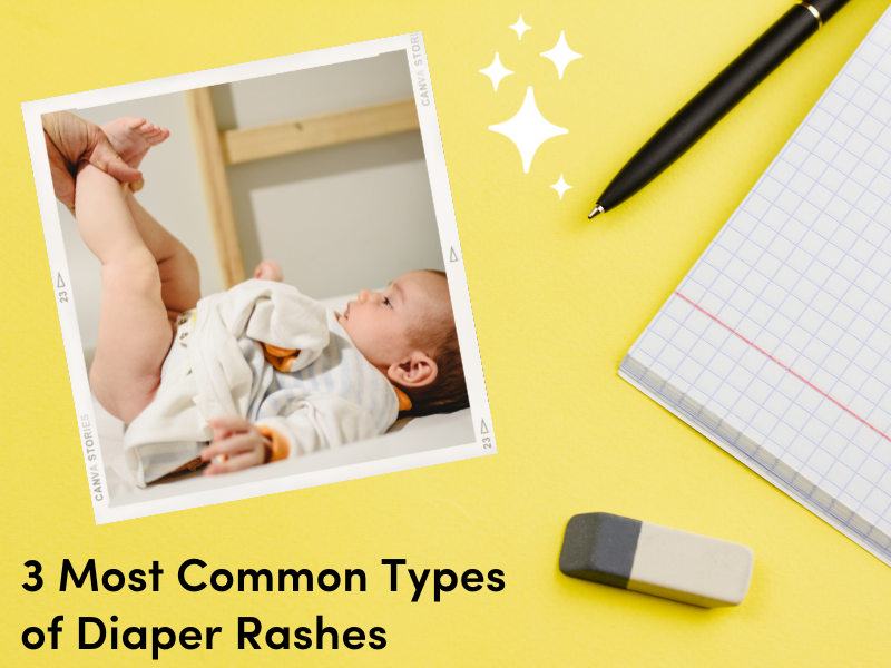 3 Most Common Types of Diaper Rashes – La Petite Creme