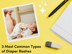 3 Most Common Types of Diaper Rashes