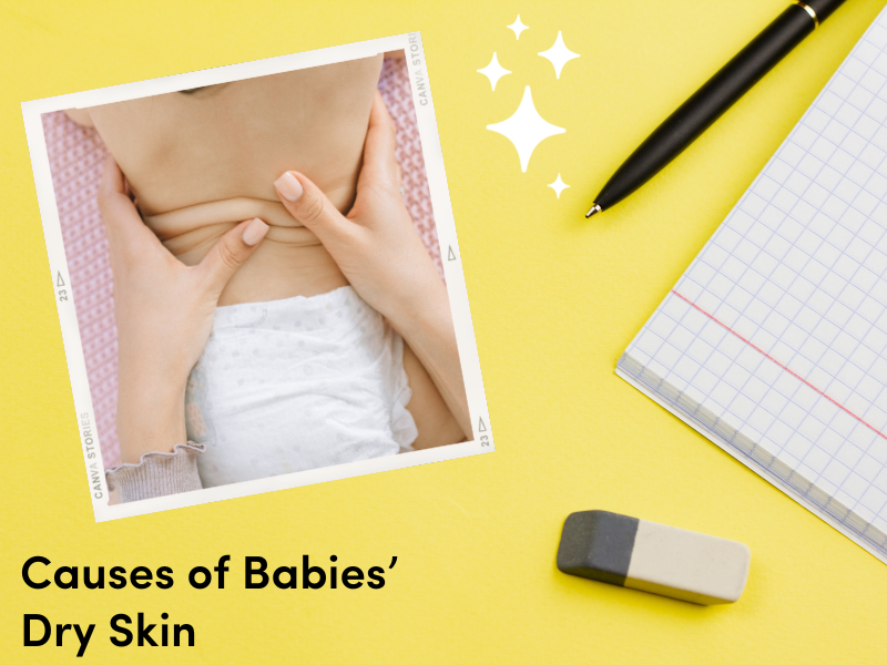 Causes of Babies’ Dry Skin La Petite Creme