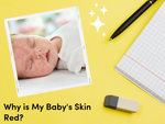 Why is My Baby's Skin Red?