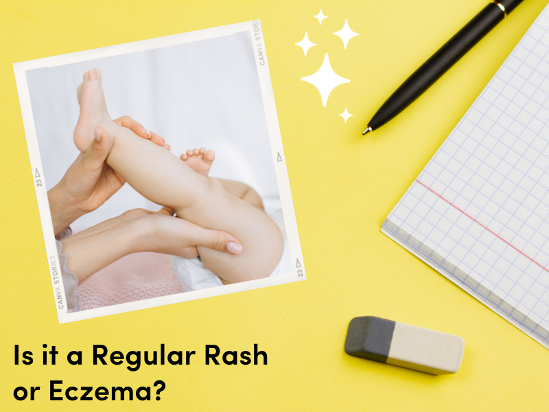 Is it a Regular Rash or Eczema?